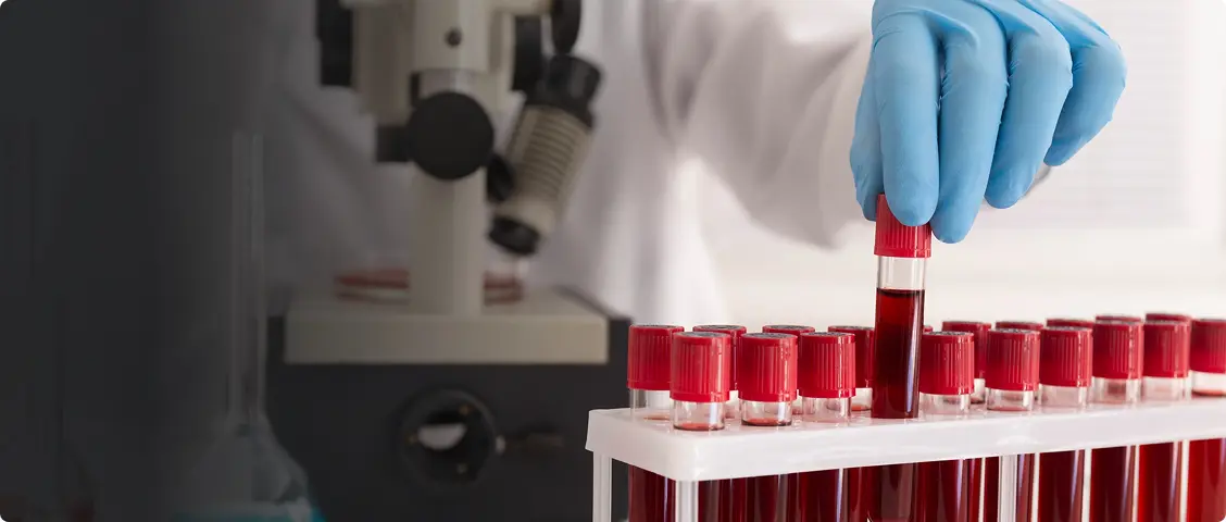 Lab Blood Tests
