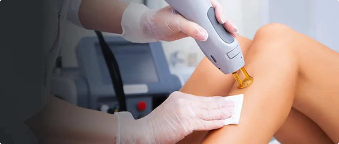 Laser Hair Removal